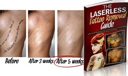 The Laserless Tattoo Removal Guide Review